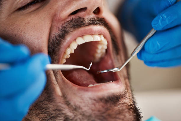 Best Pediatric Emergency Dentist in North Judson, IN