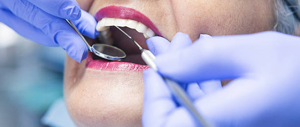 Best Emergency Dental Care for Broken or Chipped Teeth in North Judson, IN